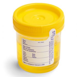 Primer uzorka - Urinokultura